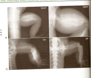 Kỹ thuật trị bệnh loãng xương Rồng Nam Mỹ-1
